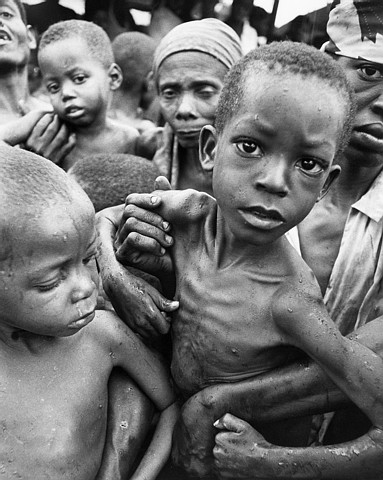 starving children in africa. be starving, but it#39;s your